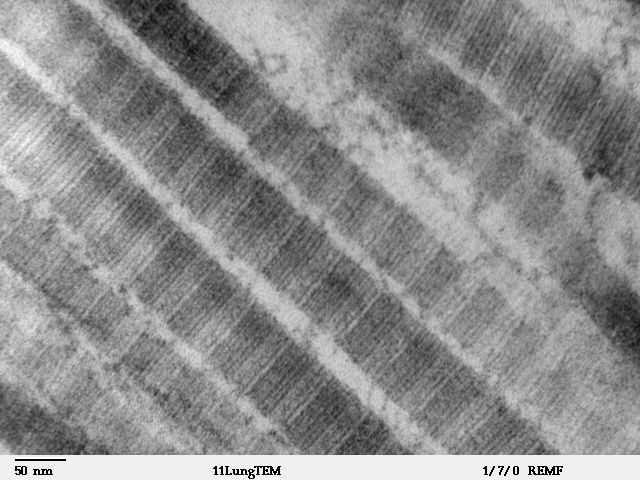 Transmission electron micrograph of densely-packed type-I collagen fibrils showing the characteristic 67 nm banded periodicity, the structural protein over-deposited in Peyronie plaque.